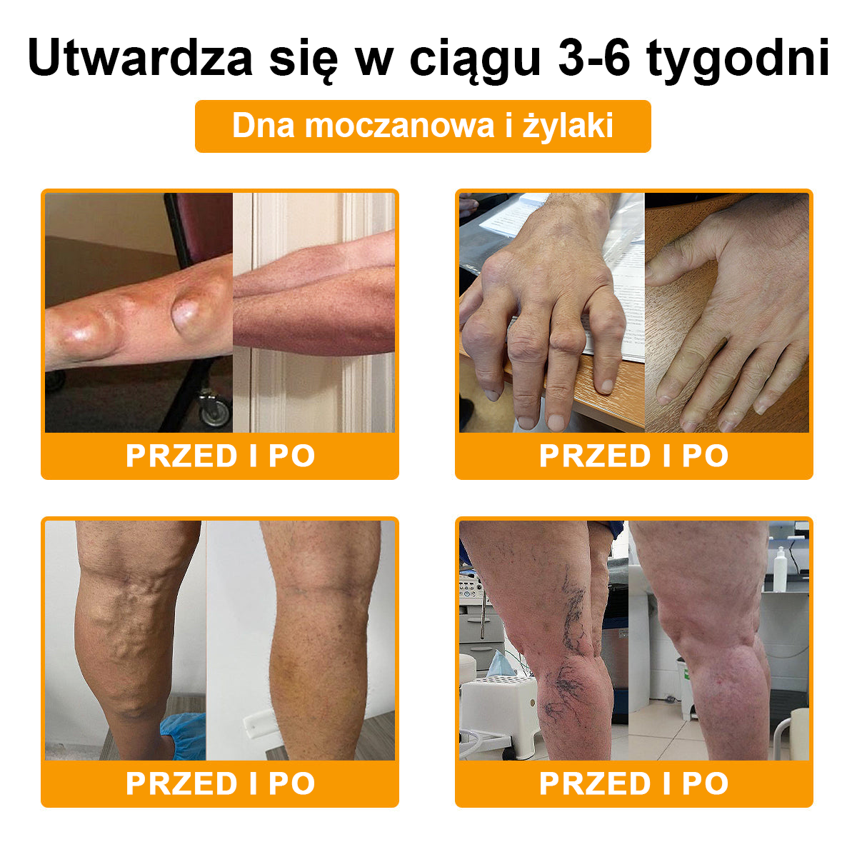 TLOPA® 🔥Toksyna botulinowa i jad pszczeli Balsam Łagodzący Ból i Leczenie Kości🐝🌿 (Polecane dla seniorów przez ortopedów)🔥