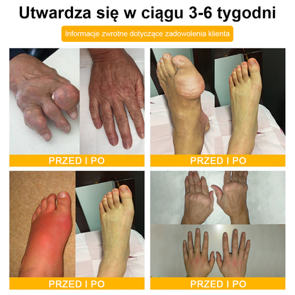 TLOPA® 🔥Toksyna botulinowa i jad pszczeli Balsam Łagodzący Ból i Leczenie Kości🐝🌿 (Polecane dla seniorów przez ortopedów)🔥